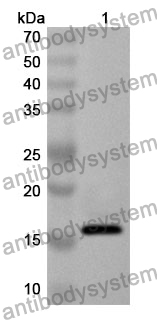 Anti-CGB3 Polyclonal Antibody