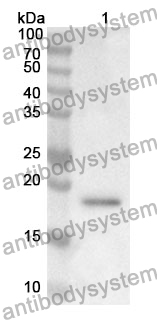 Anti-CALM1 Polyclonal Antibody