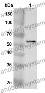 Anti-AMY1A Polyclonal Antibody