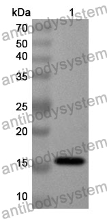 Anti-CALCB Polyclonal Antibody