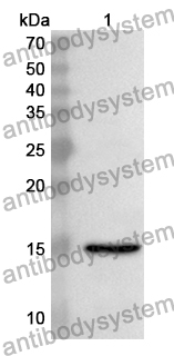 Anti-Human FDX1 Polyclonal Antibody