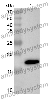 Anti-Human RNASE2 Polyclonal Antibody