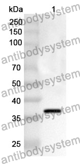 Anti-AR Polyclonal Antibody