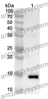 Anti-RARA Polyclonal Antibody