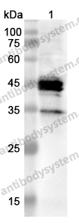 Anti-HLA-C Polyclonal Antibody