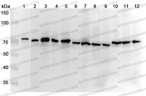 Anti-DLAT Polyclonal Antibody