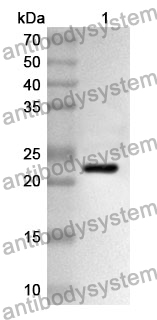 Anti-PTPRF Polyclonal Antibody