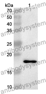 Anti-Human MAPT/Tau/PHF-tau Polyclonal Antibody