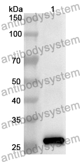 Anti-Human C7/Complement component C7 Polyclonal Antibody