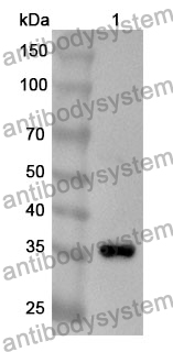 Anti-CHGA Polyclonal Antibody