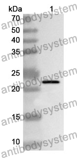 Anti-TFPI Polyclonal Antibody