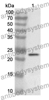 Anti-CD117/KIT Polyclonal Antibody