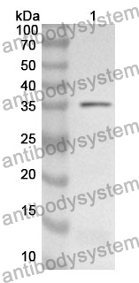 Anti-RBP3 Polyclonal Antibody