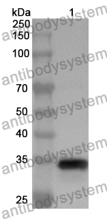 Anti-ESD Polyclonal Antibody