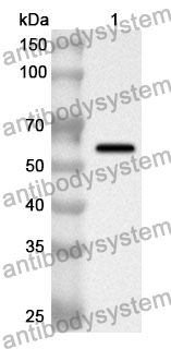 Anti-HSPD1 Polyclonal Antibody