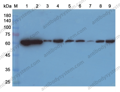 Anti-HSPD1 Polyclonal Antibody