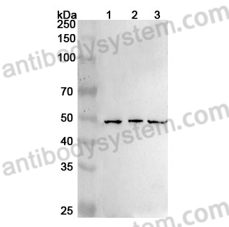 Anti-Human RARB Polyclonal Antibody