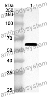 Anti-THRA Polyclonal Antibody