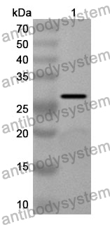 Anti-THRB Polyclonal Antibody