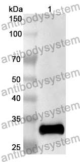 Anti-Human GHR Polyclonal Antibody