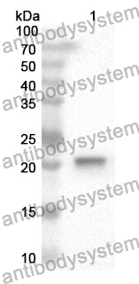 Anti-MYL2 Polyclonal Antibody