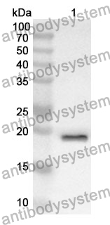 Anti-CD8B Polyclonal Antibody