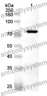 Anti-HSPA5 Polyclonal Antibody