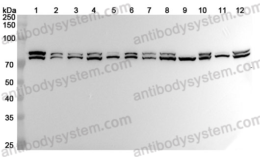 Anti-HSPA5 Polyclonal Antibody