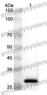 Anti-LAMC1 Polyclonal Antibody