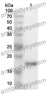 Anti-CD37 Polyclonal Antibody