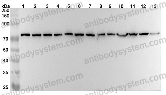 Anti-HSPA8 Polyclonal Antibody