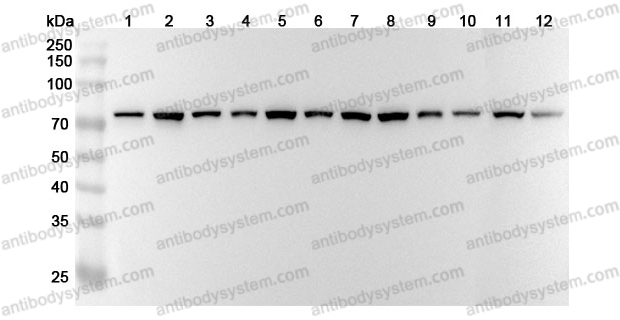 Anti-HSPA8 Polyclonal Antibody