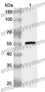 Anti-Human LIPC Polyclonal Antibody