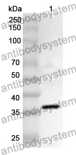 Anti-SLC2A3 Polyclonal Antibody