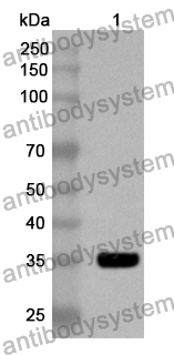 Anti-EPB41 Polyclonal Antibody