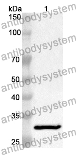 Anti-Human UMPS Polyclonal Antibody