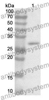 Anti-PYGB Polyclonal Antibody