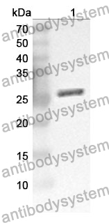 Anti-RALA Polyclonal Antibody