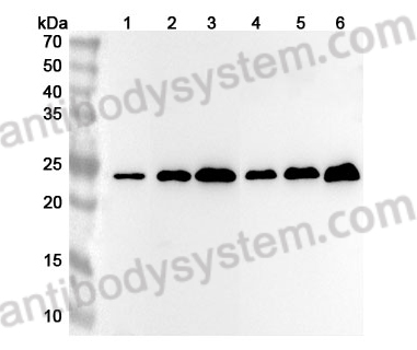 Anti-Human RALB Polyclonal Antibody