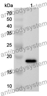 Anti-BCR Polyclonal Antibody