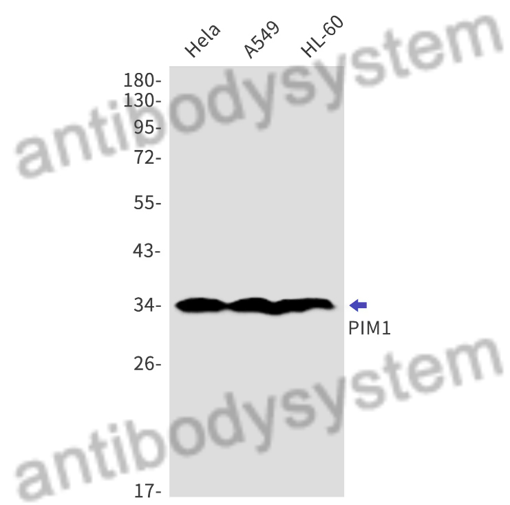 Anti-PIM1 Polyclonal Antibody