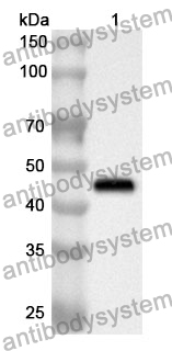 Anti-Human ACADM Polyclonal Antibody