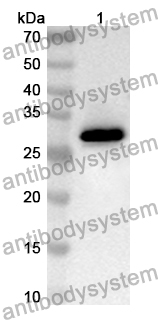 Anti-TOP2A Polyclonal Antibody