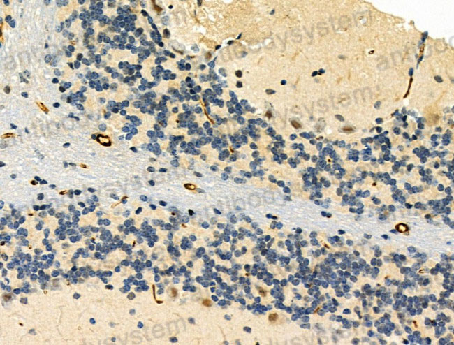 Immunohistochemical for Anti-TOP2A Polyclonal Antibody ?>