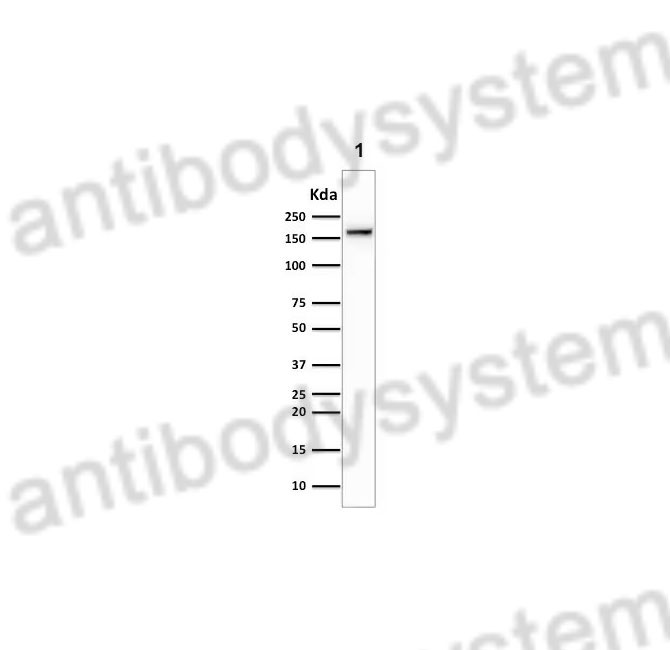 Western Blot for Anti-TOP2A Polyclonal Antibody ?>