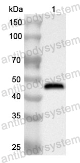 Anti-TOP2A Polyclonal Antibody