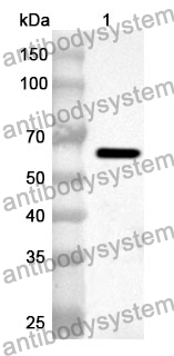 Anti-Human G6PD Polyclonal Antibody