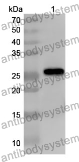 Anti-CD66f/PSG1 Polyclonal Antibody