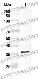 Anti-PSG2 Polyclonal Antibody