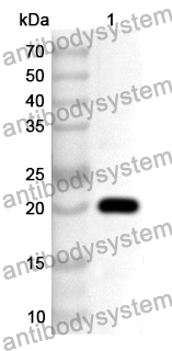 Anti-VDR Polyclonal Antibody